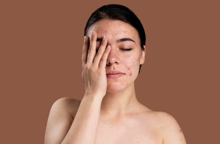 best skin doctor in faridabad