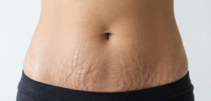 best skin doctor in faridabad